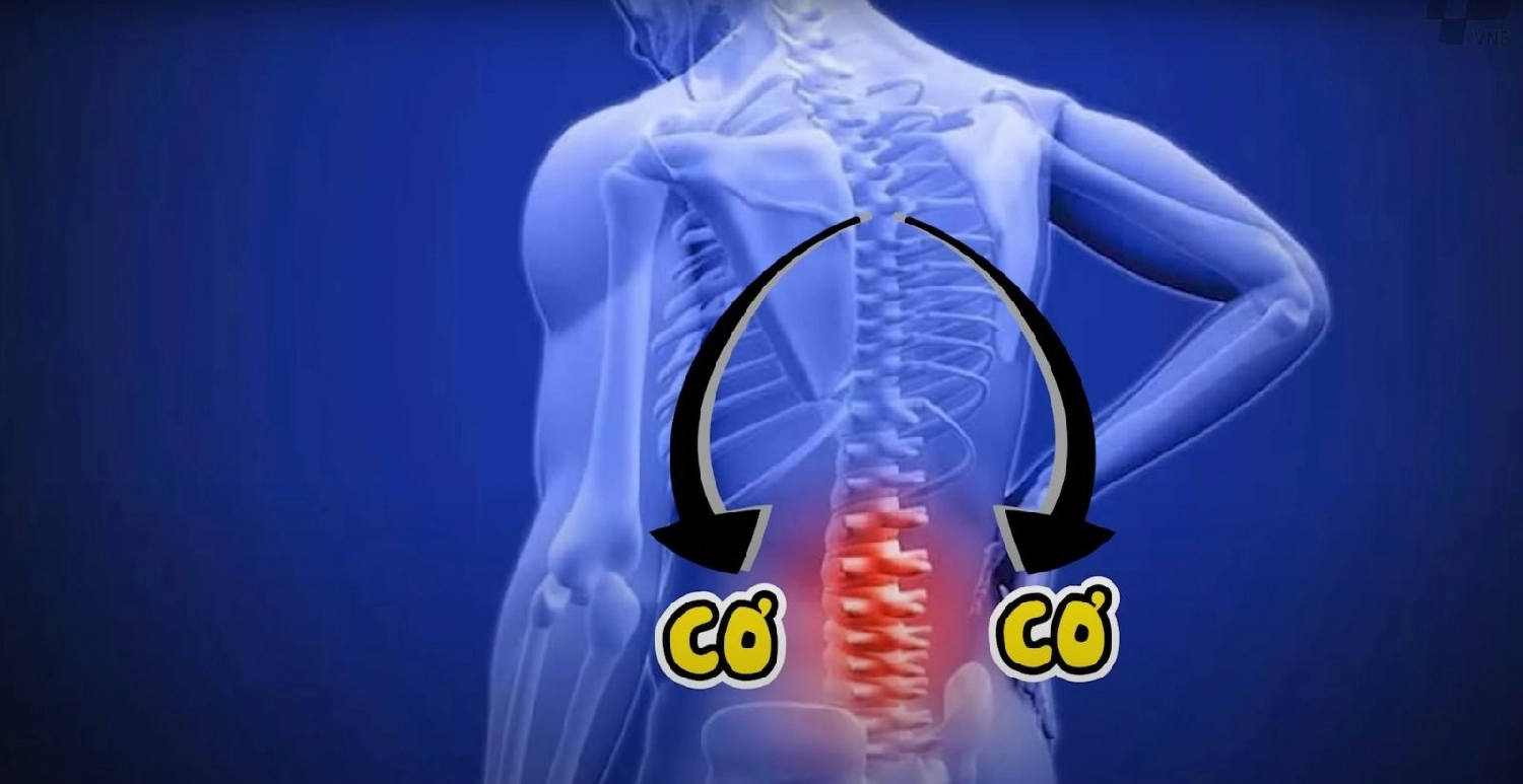 Bị đau lưng do đánh cầu lông